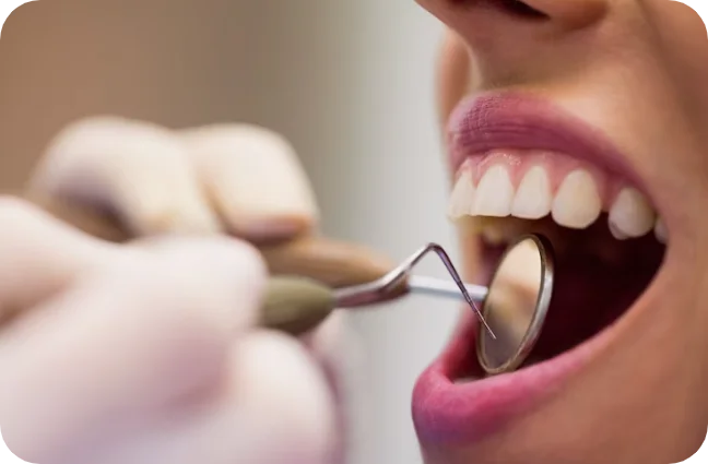 Close-up of a patient receiving a dental checkup using a specialized dental mirror