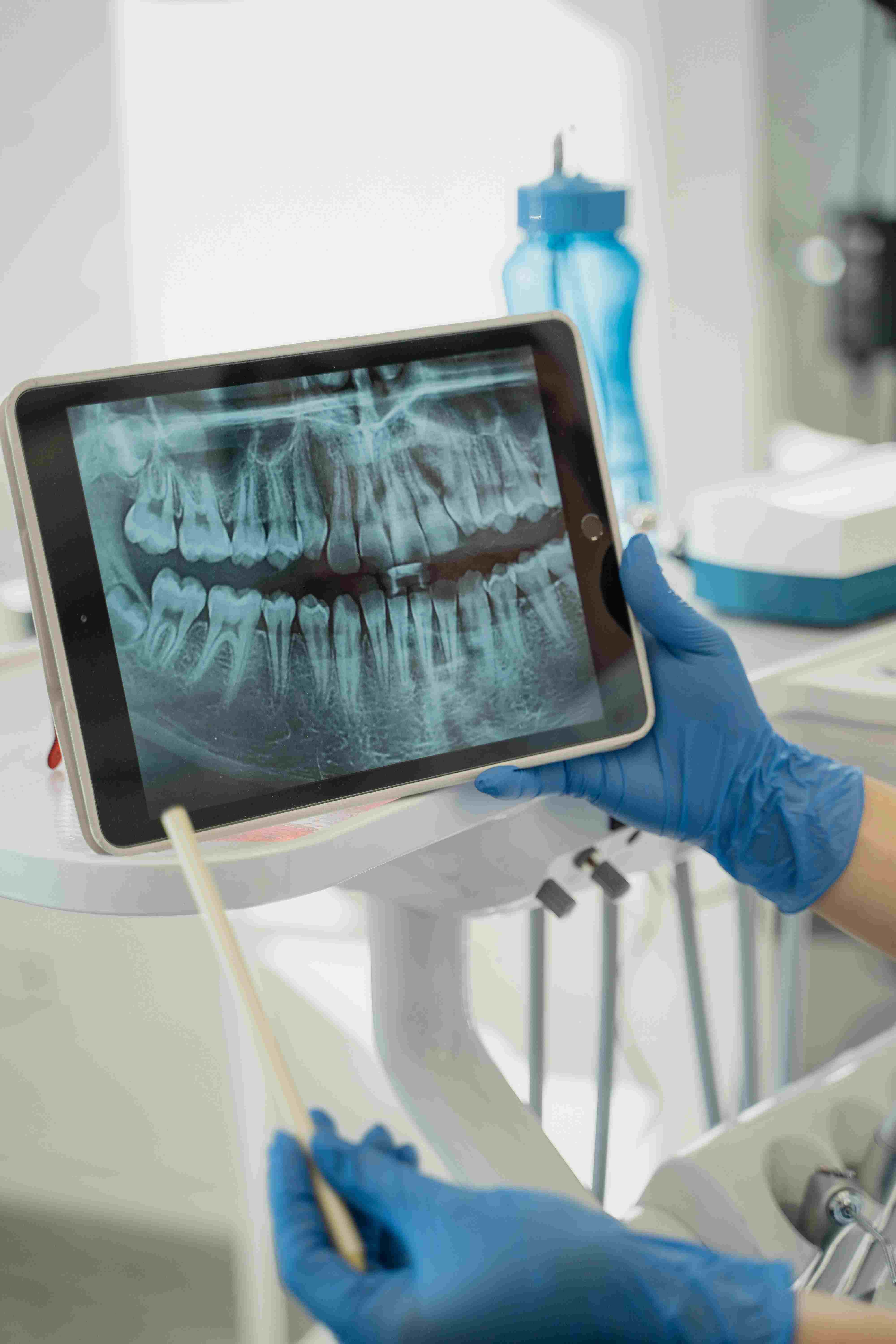 The Connection Between Oral Health and Overall Well-being