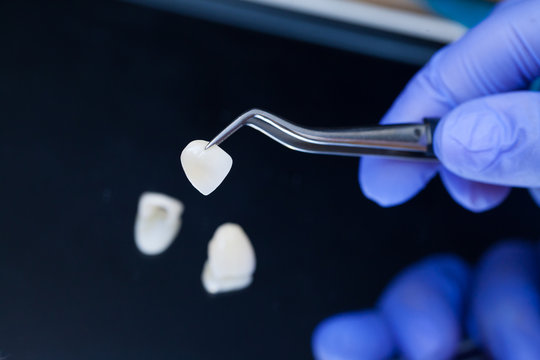 The Role of Diet in Preventing Dental Emergencies